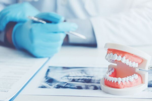 bonding zębów gdańsk